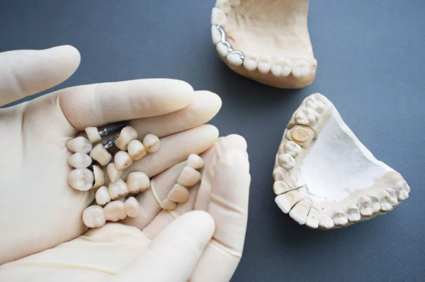 Dental Crowns, Bridges and Implants in gloved hands