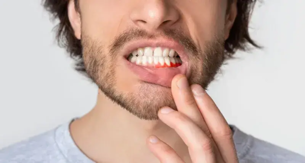 Man showing bleeding gums from gum disease