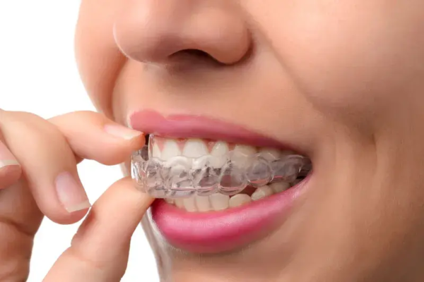 woman taking out Invisalign