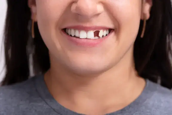 Woman missing tooth and smiling