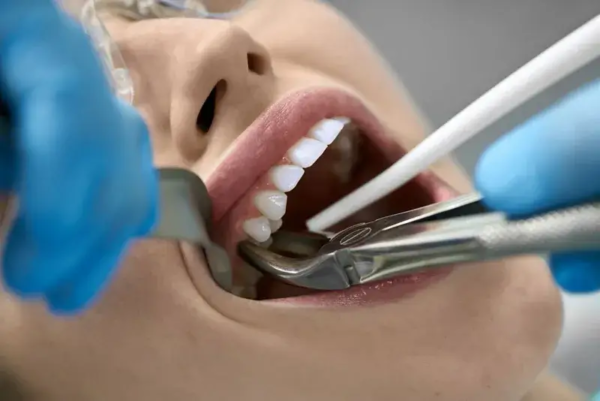 Dentist preforming tooth extraction