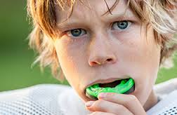 Benefits of Fitted Sports Mouthguards