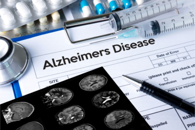 The Connection between Alzheimer's Disease and Oral health